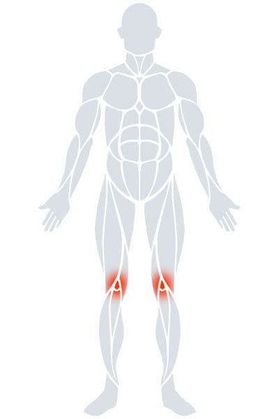 Knees